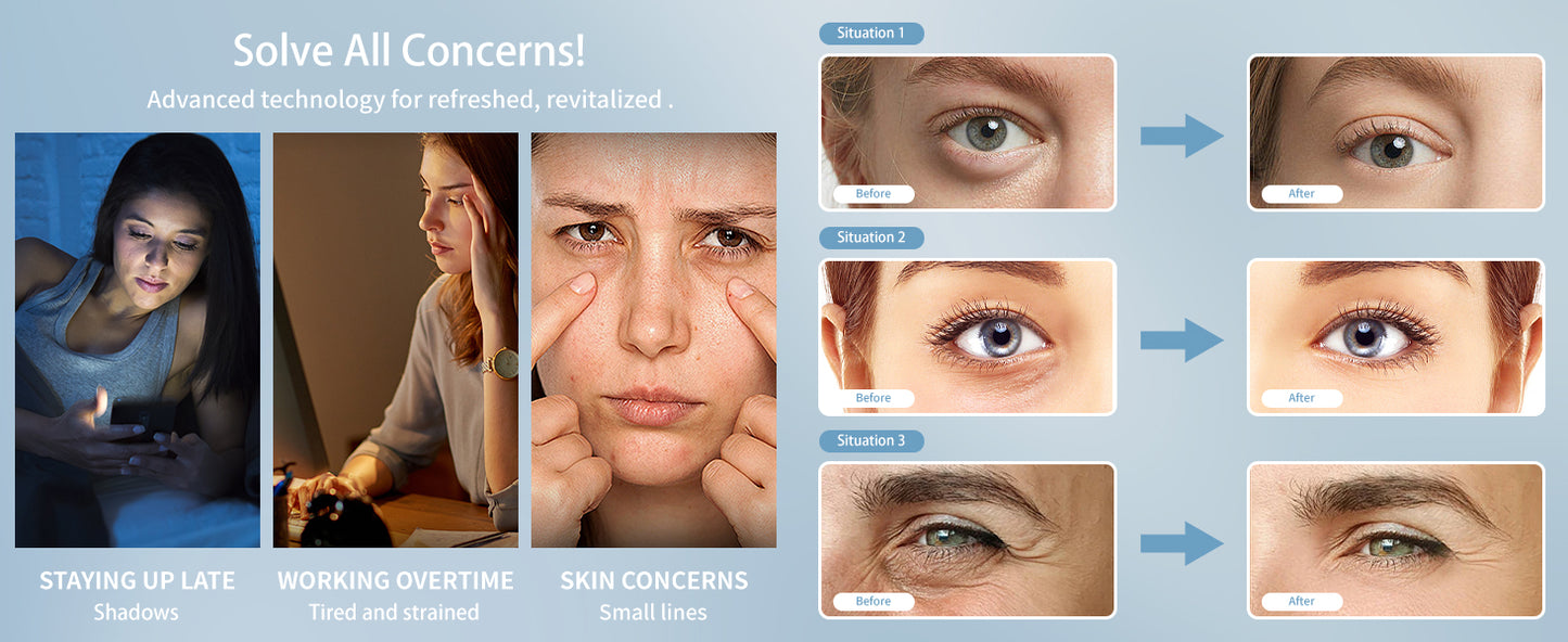 Eye Fatigue Relief Massager